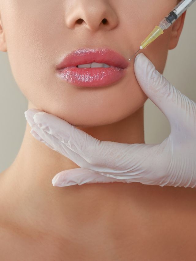 Lip Filler
